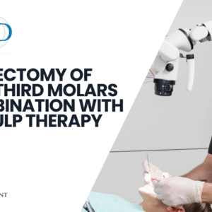 Coronectomy of Lower Third Molars in Combination with Vital Pulp Therapy